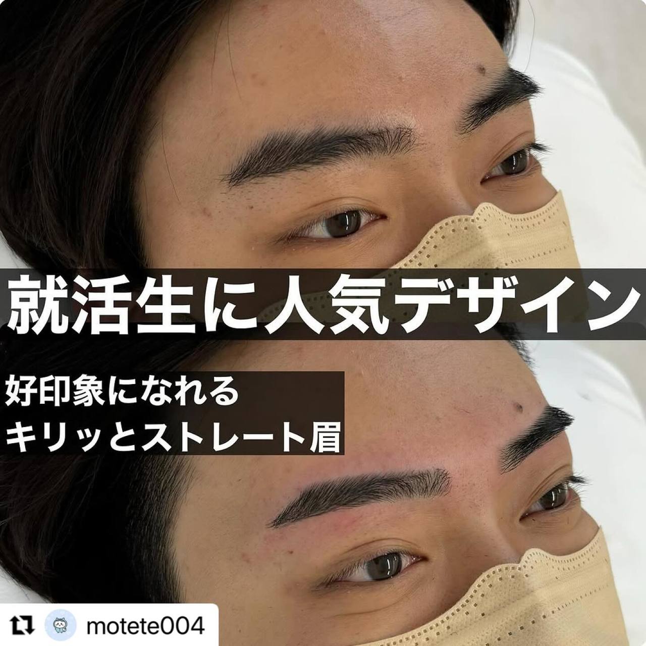 施術当日の過ごし方