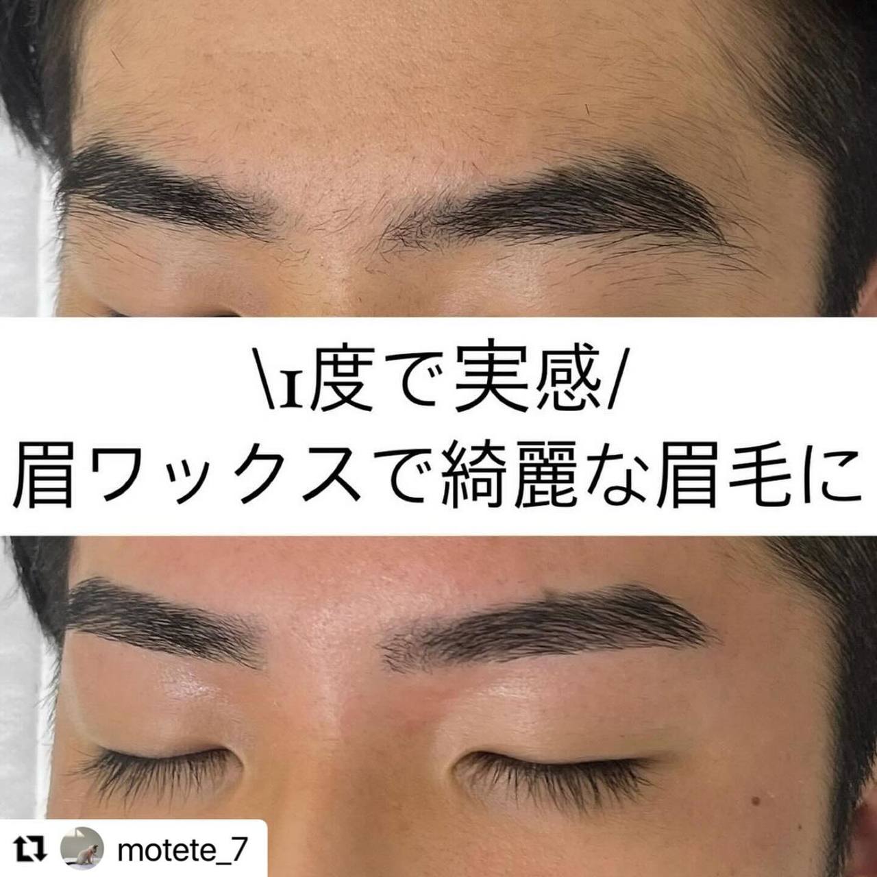 施術後に気をつけたいこと