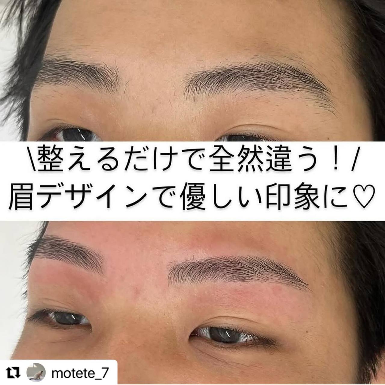 施術メニューの組み合わせ例