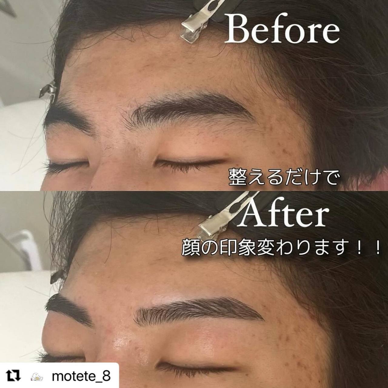 池袋 眉毛サロン | 頬のワックス脱毛とは？