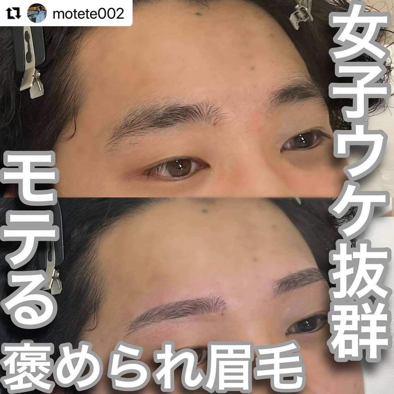 池袋 メンズ眉毛 | 顔の産毛は処理すべき？